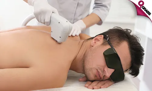 Laser Hair Removal for Men!